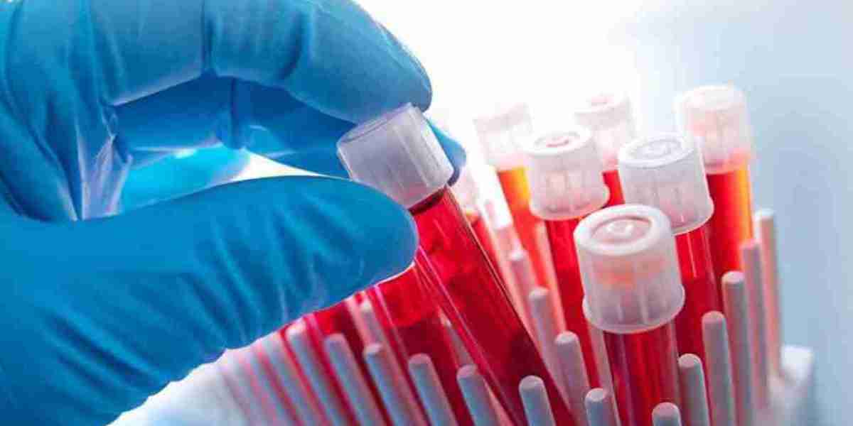 Swab and Viral Transport Medium Market Growth, Size & Forecast Report to 2032