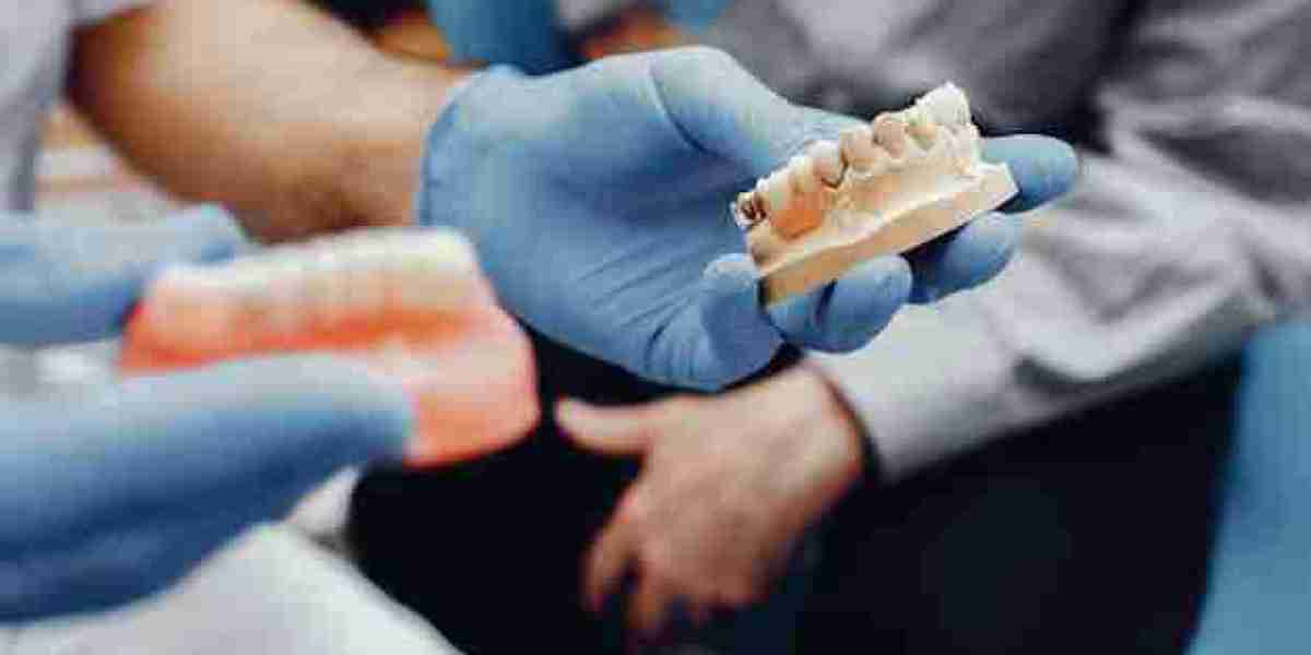 What Is the Process for Getting Dental Implants in Birmingham?