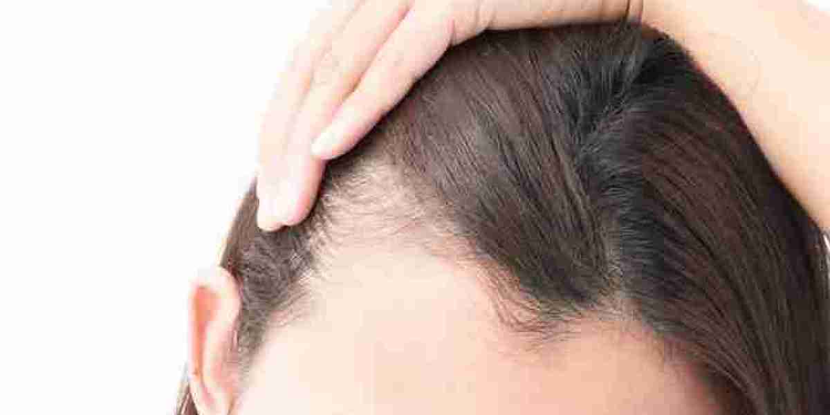 The Role of Plasma Injections Hair Loss Treatments