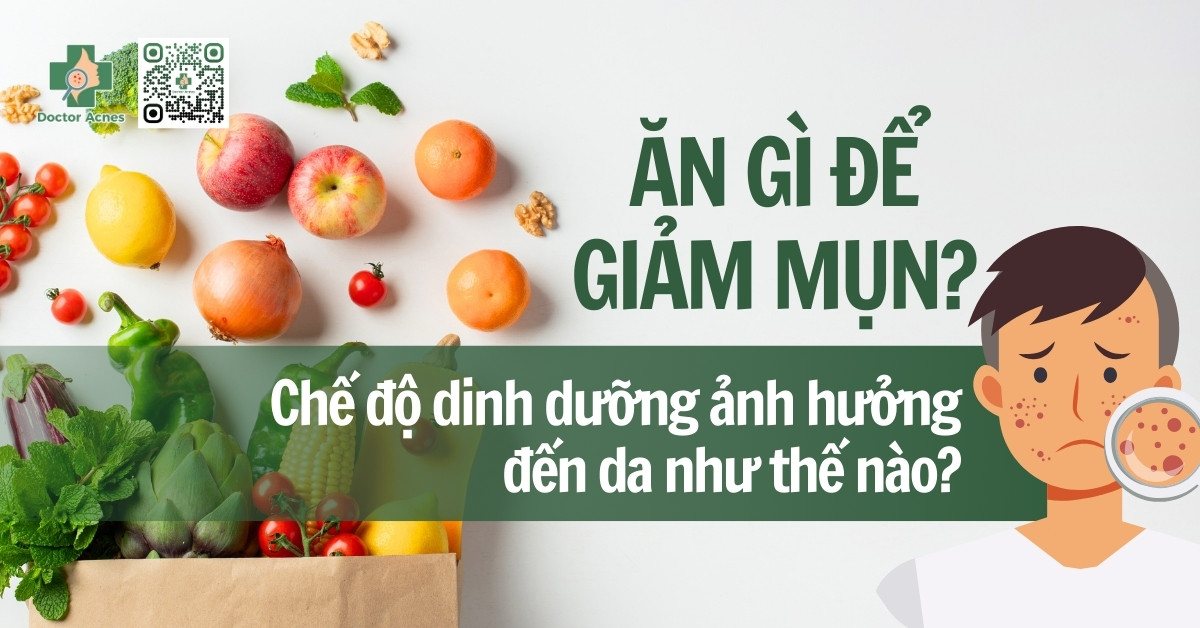 Ăn gì để hết mụn? Các loại thực phẩm giúp giảm mụn hiệu quả