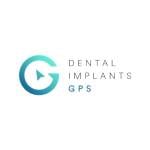 Dental Implants GPS