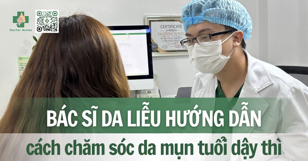 Bí quyết chăm sóc da mụn tuổi dậy thì hiệu quả từ Bác sĩ Da liễu