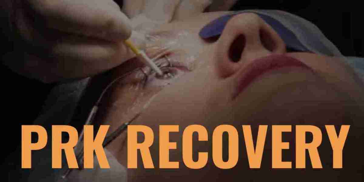 PRK Recovery Tips: What to Expect After Surgery