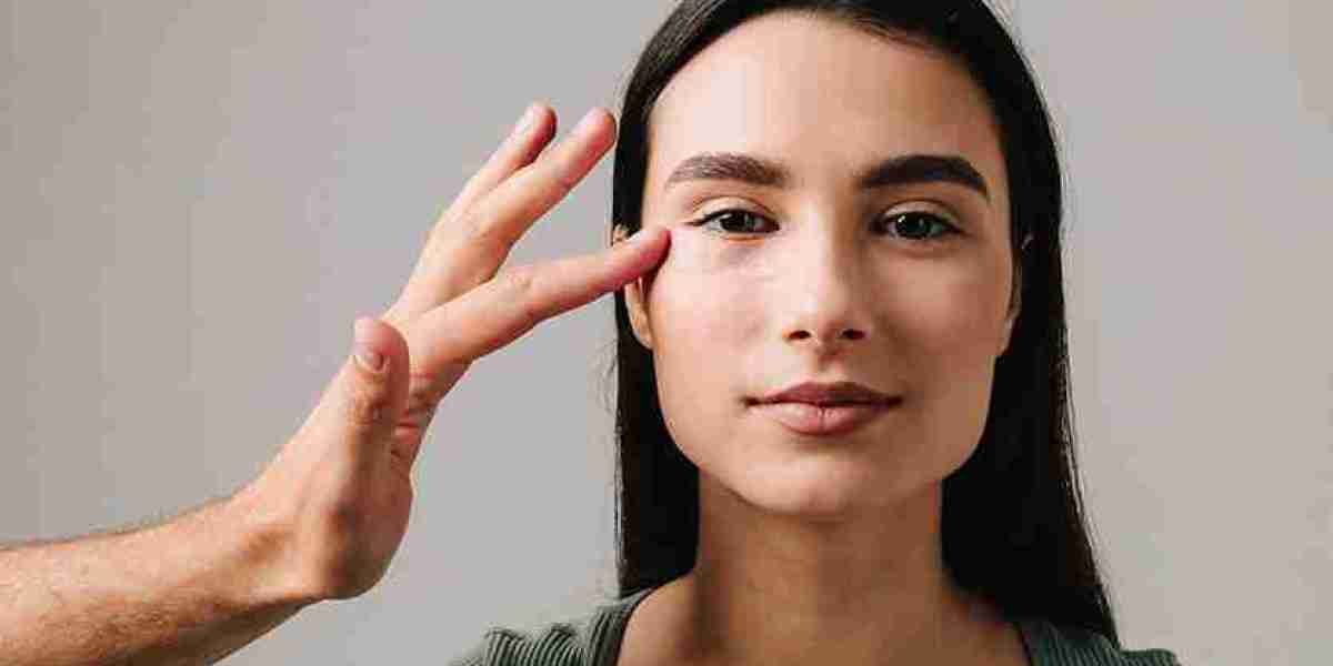 BLEPHAROPLASTY – TO IMPROVE YOUR EYE VISION AND OVERALL LOOK | KOSMODERMA SKIN CLINIC IN BANGALORE