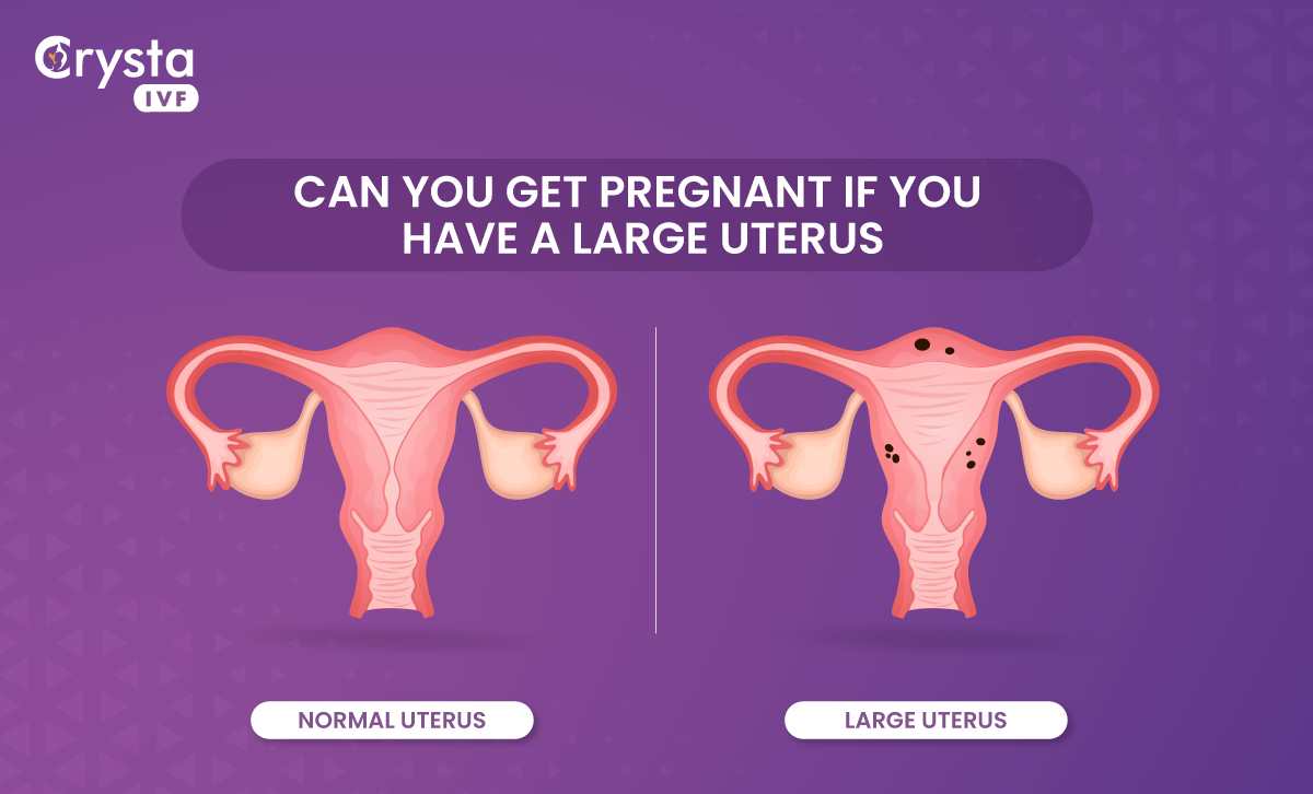 Bulky Uterus Meaning: Can You Get Pregnant If You Have A Large Uterus?