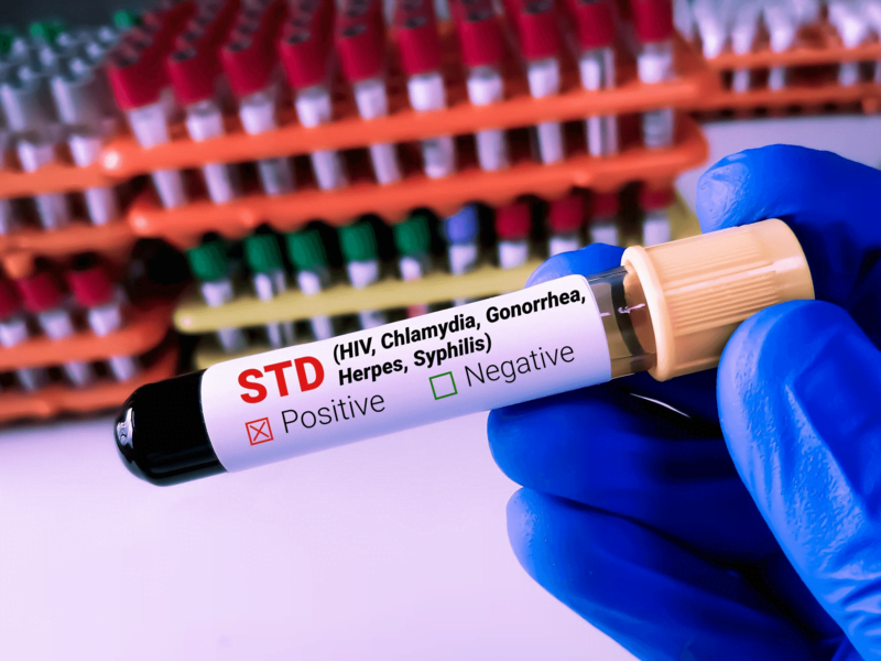 STD Screening Clinic Singapore | STI Treatment Clinic