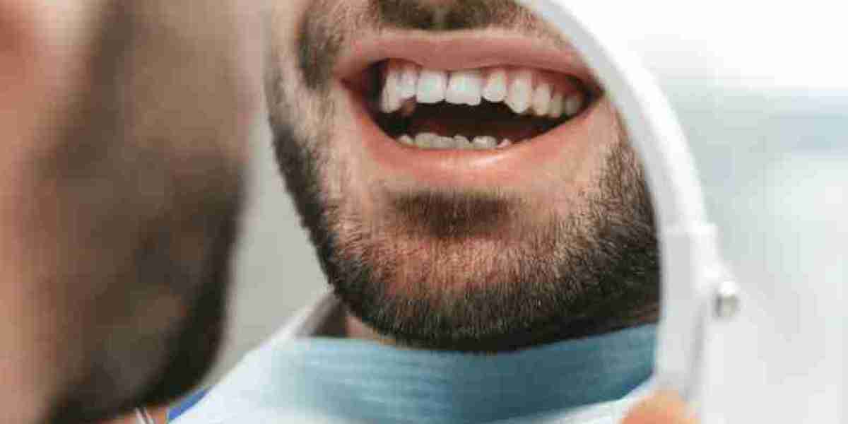 Dental Fillings: Maintaining Tooth Strength