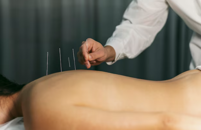 Understanding the Long-Term Benefits of Acupuncture for Weight Loss - Asian Travel Blogs – Real Stories, Real Adventures