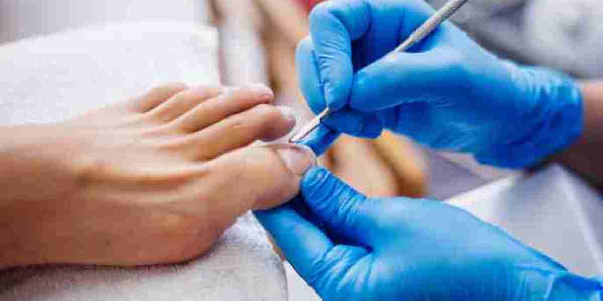 How to Address and Treat Ingrown Toenails at an Ingrown Toenail Clinic