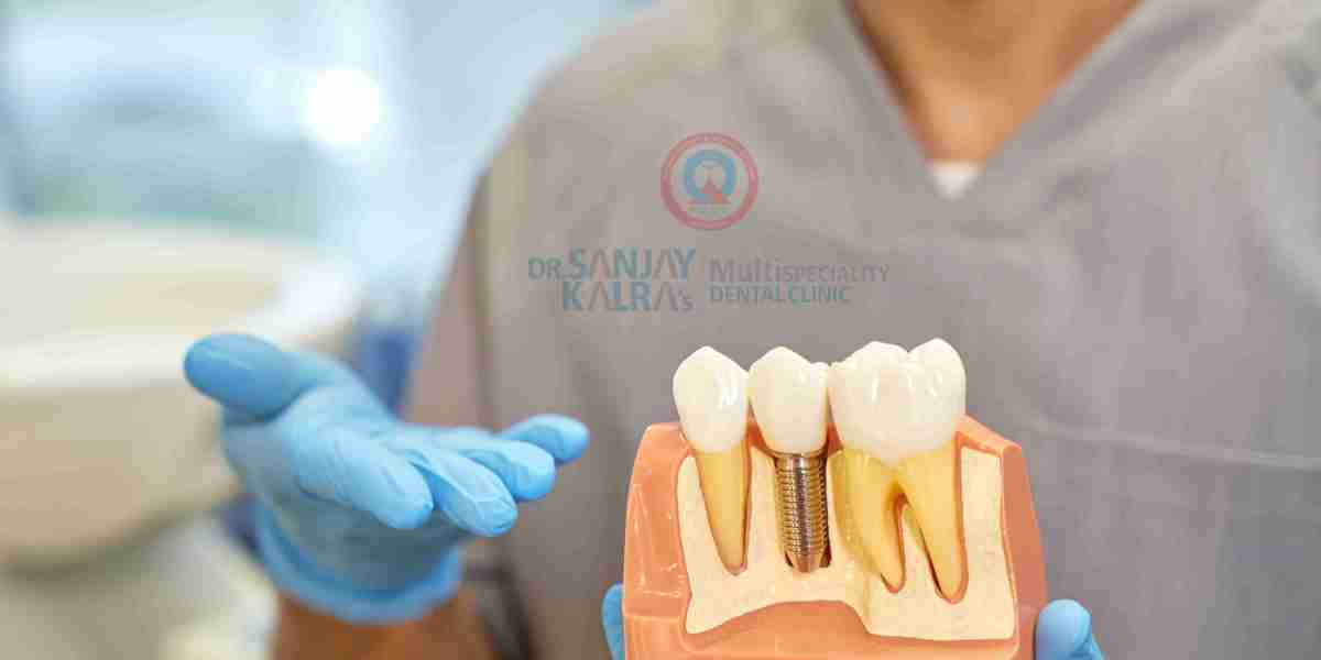 Indian Oral Health: A Growing Concern and the Way Forward