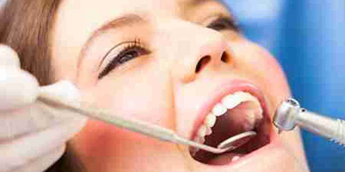 What Are the Different Types of Dental Crowns and Bridges?