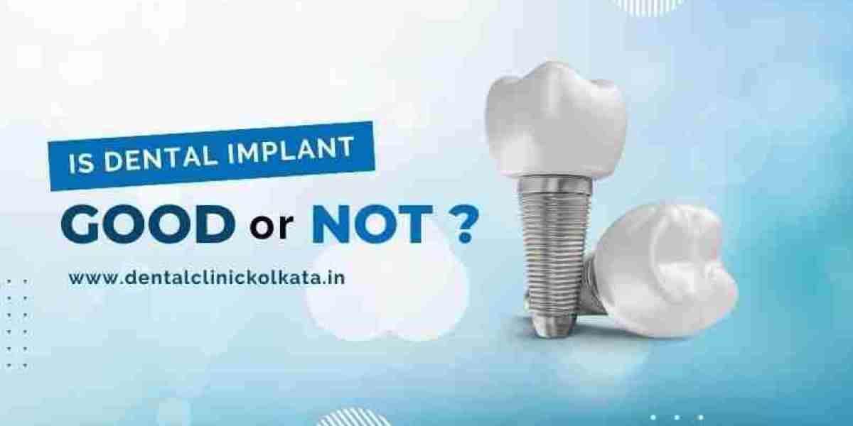 Is Dental Implant Good or Not?