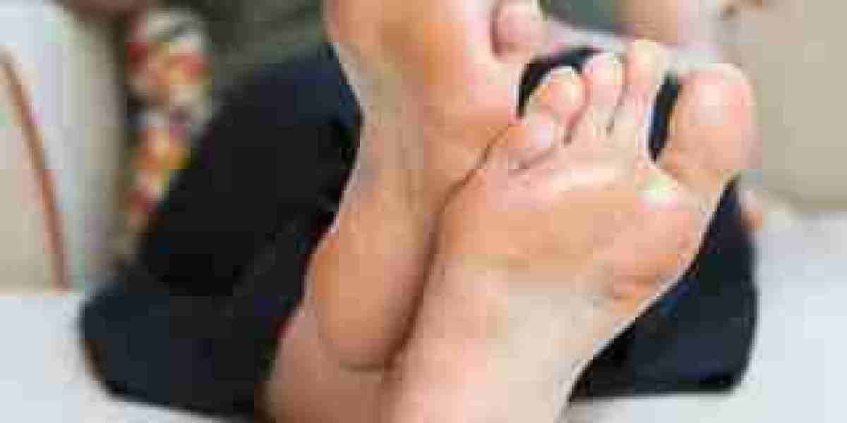 Riyadh Dermatologists Recommend Botox for Sweaty Feet