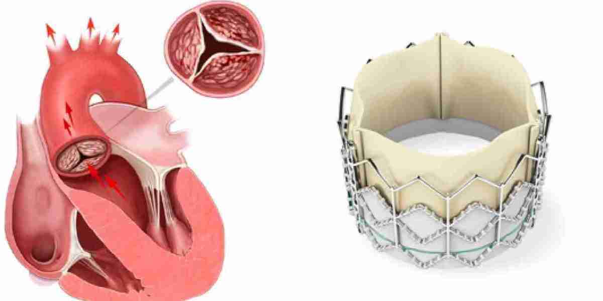 Prosthetic Heart Valves Market: Key Market Segments, Trends, and Long-Term Forecast