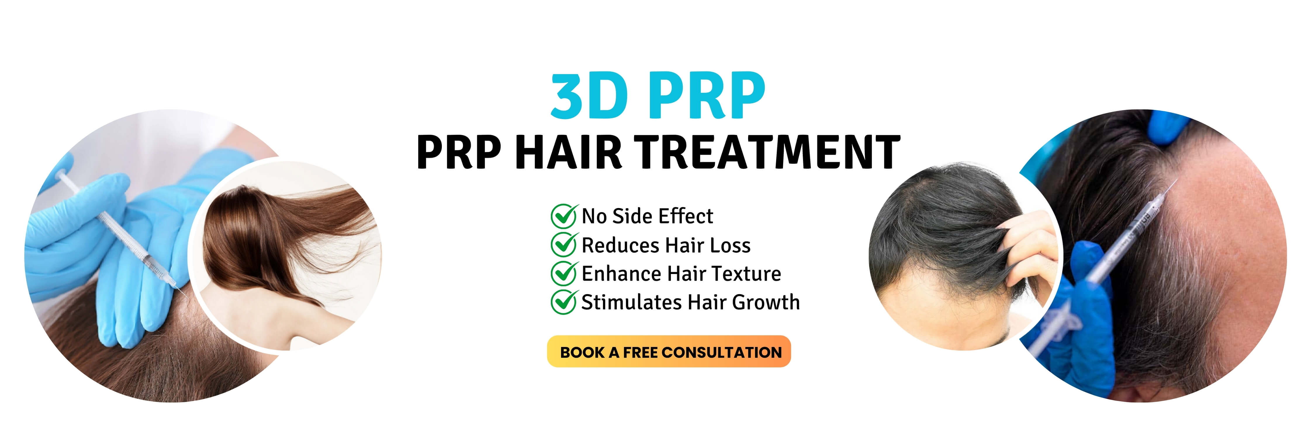 3D prp hair treatment in Pakistan | prp for hair near me | 3D Lifestyle PK