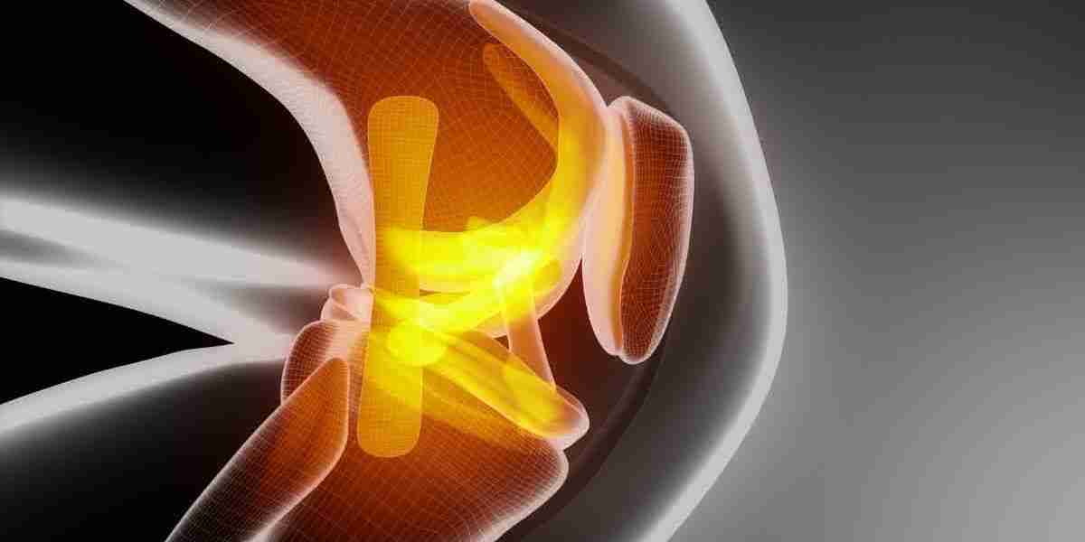 Perspectivas de Crecimiento del Mercado de Reparación de Cartílago de Rodilla hasta 2032
