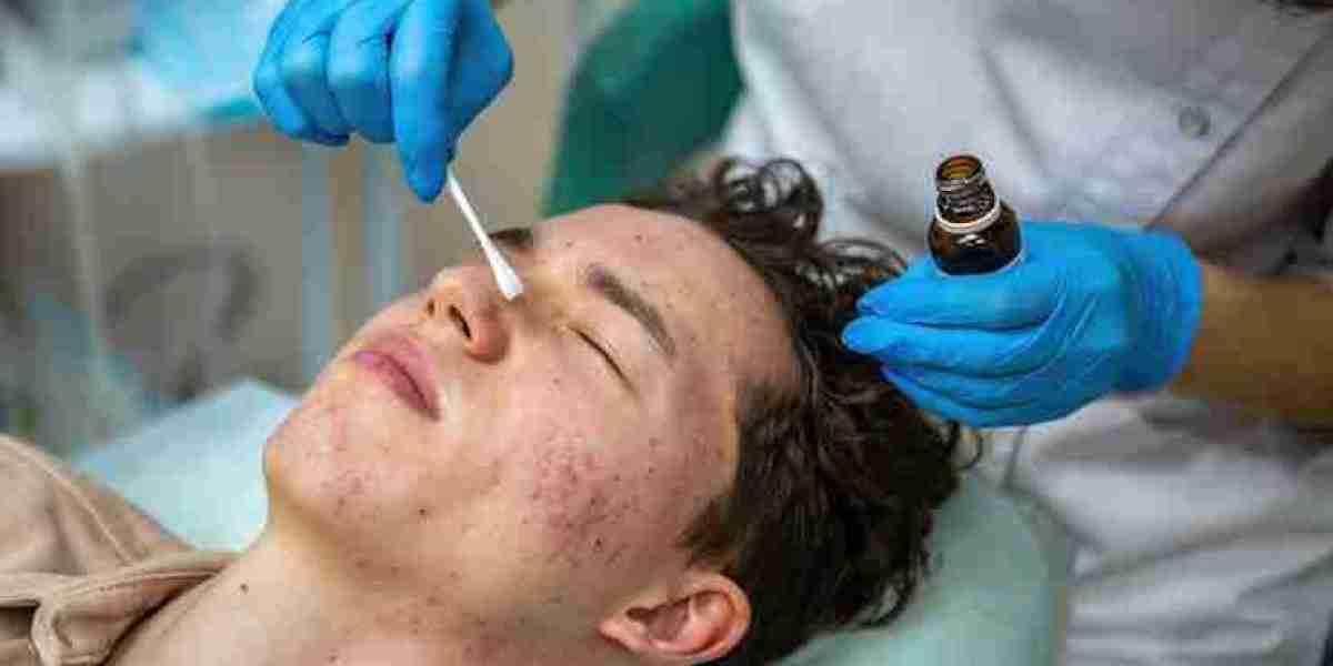 Clear Skin Goals: Best Clinics for Acne Treatment in Manchester