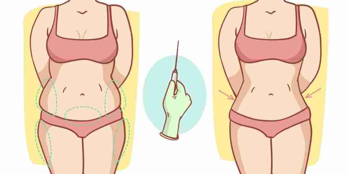 Sculpt Your Ideal Midsection with a Tummy Tuck in Los Angeles