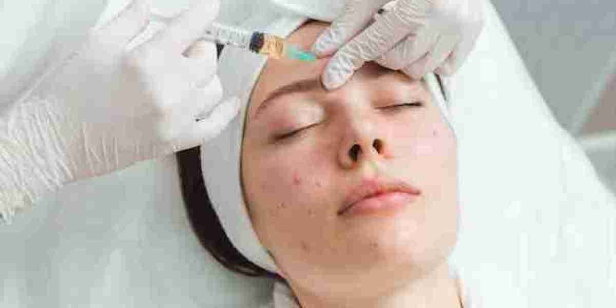 Steroid Injections for Acne in Dubai: Fast Relief for Severe Skin Conditions