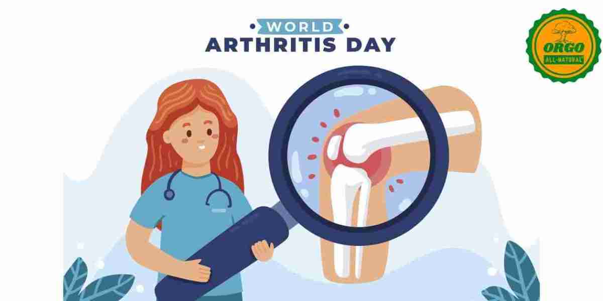 Top 10 Natural Remedies for Managing Arthritis Pain