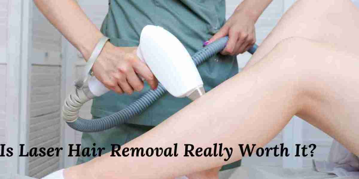 Is Laser Hair Removal Really Worth It?