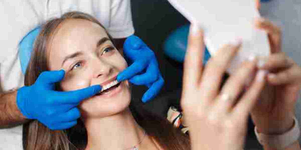 DIY Teeth Whitening vs. Professional Treatments: Pros and Cons