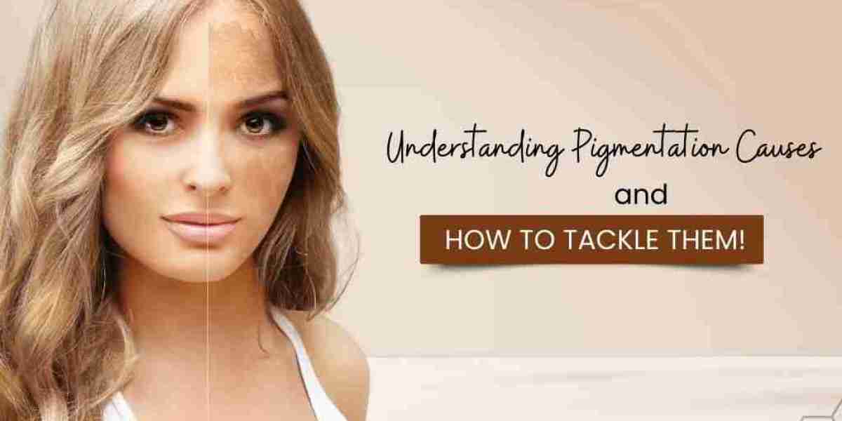 Understanding Pigmentation Causes & Solutions