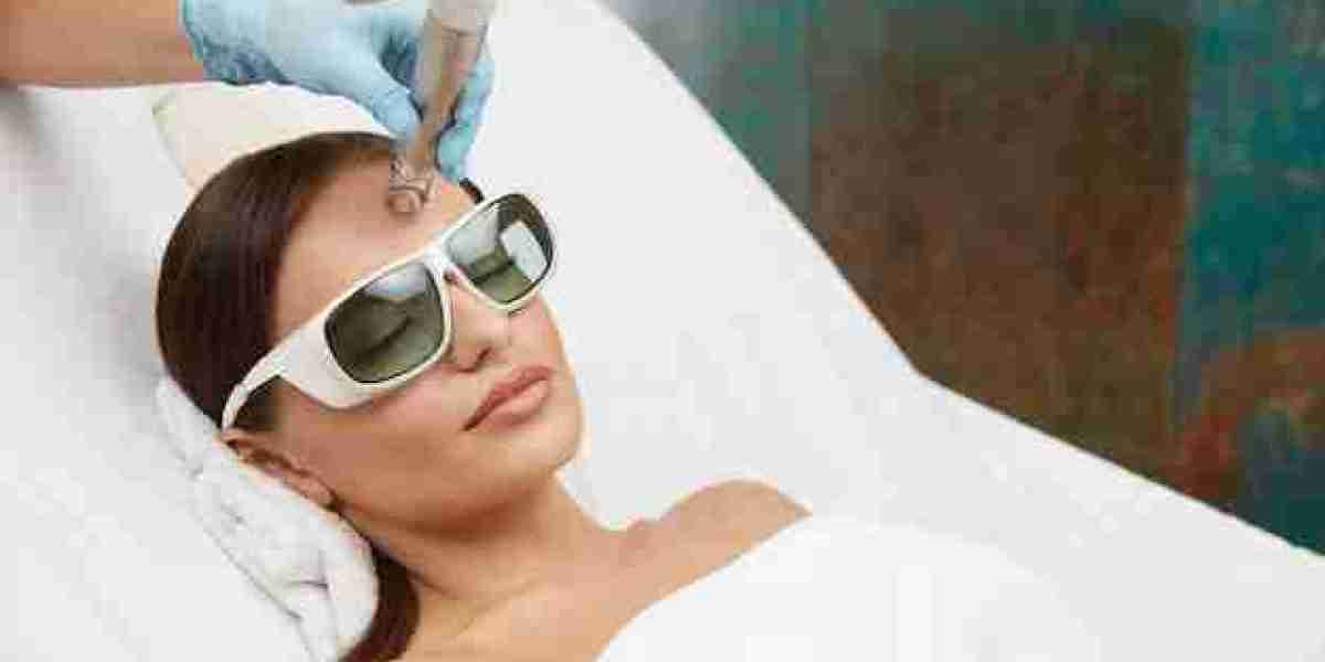 Clearskin Laser Treatment: The Ultimate Solution for Clearer Skin