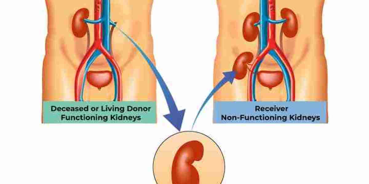 How does Swanand Kidney Clinic approach kidney transplantation for patients with end-stage renal disease, and what suppo