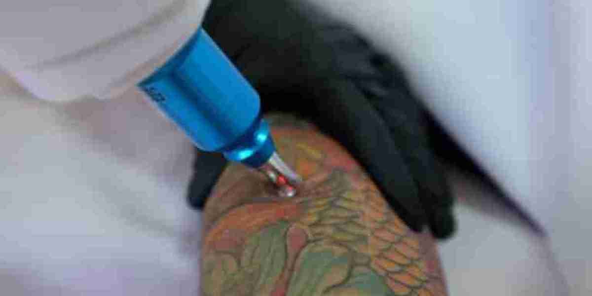 How Permanent Tattoo Removal in Dubai is Changing Lives