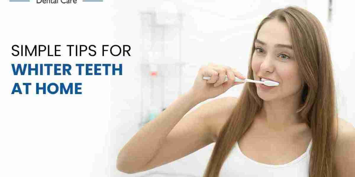 5 Simple Tips for Whiter Teeth at Home