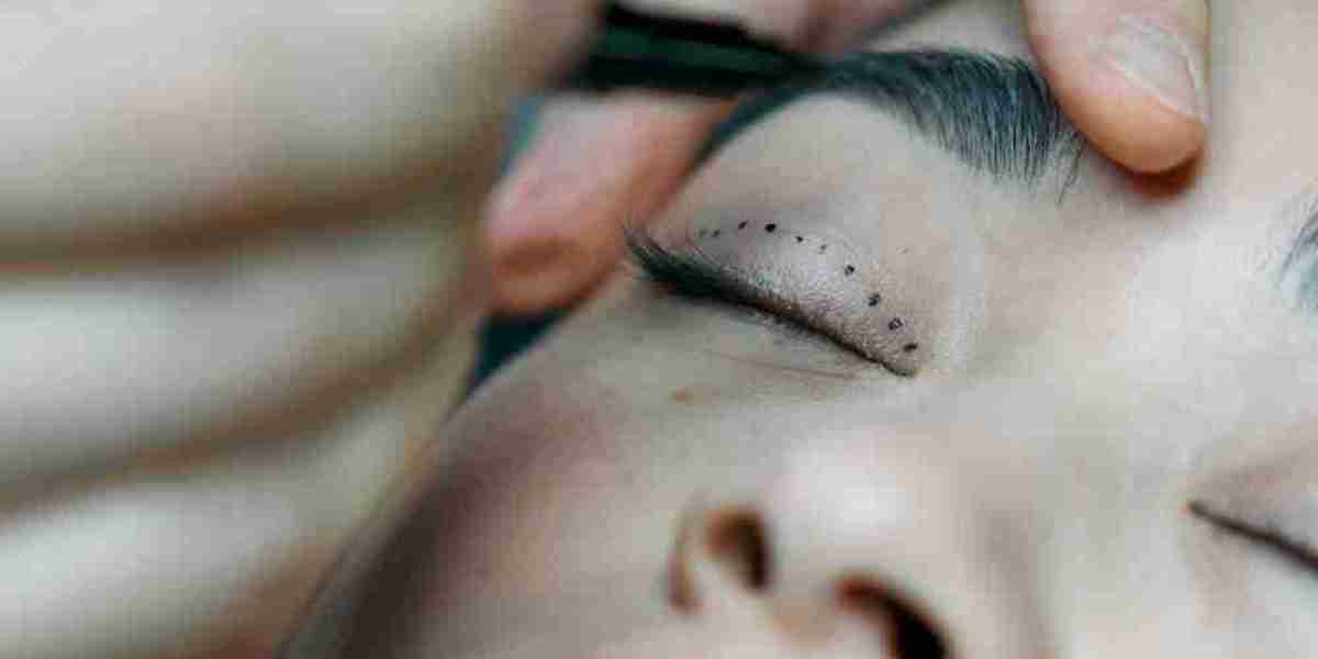 Achieving Youthful Eyes with Glamorous Clinic’s Eyelid Surgery