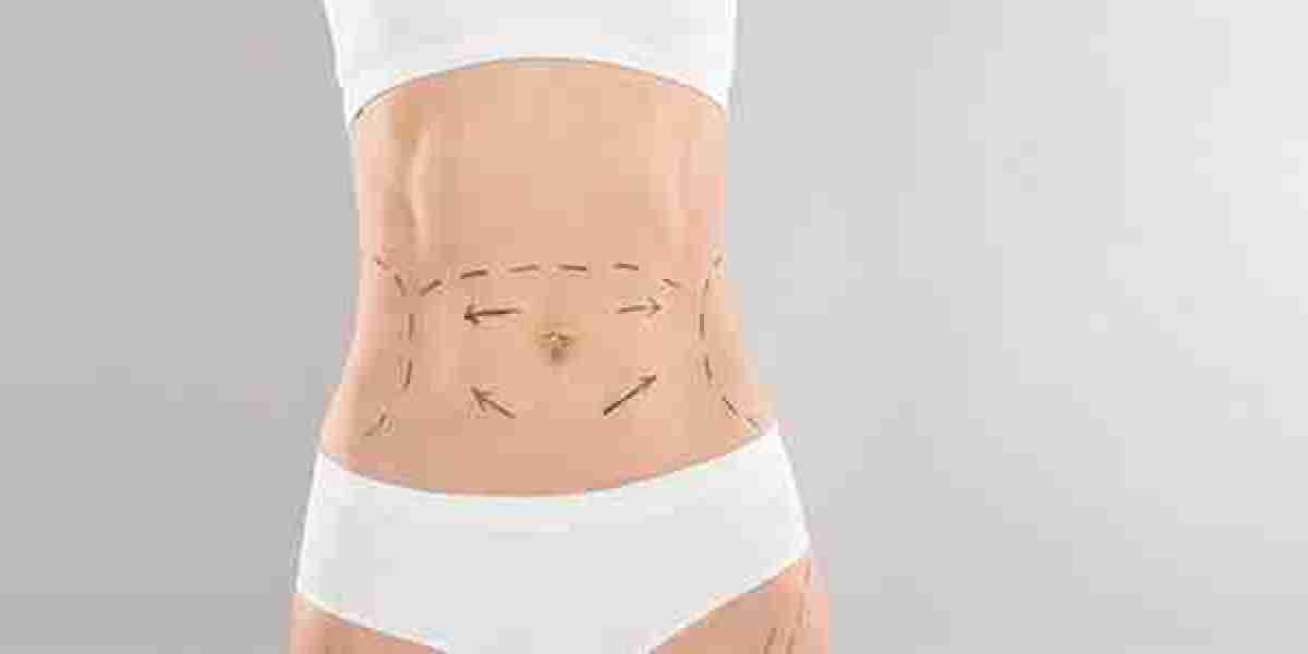 Understanding Tummy Tuck Options Available