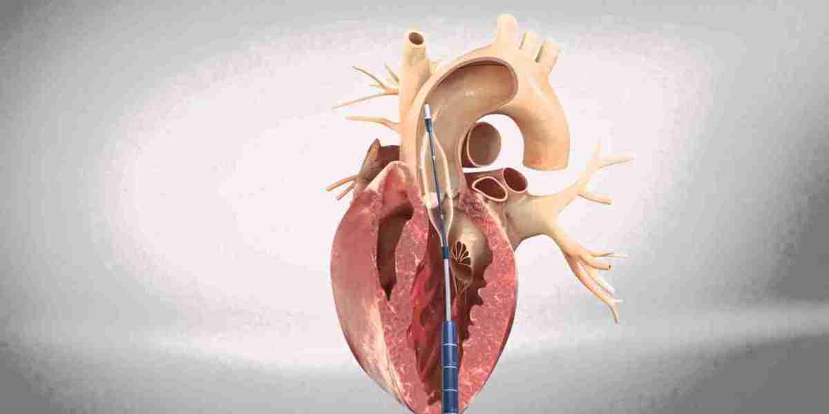 Understanding Transcatheter Aortic Valve Replacement (TAVR)