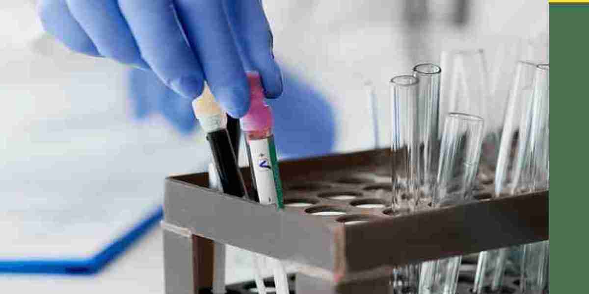 Understanding Urine Sample Collection and Clinfinite Solutions