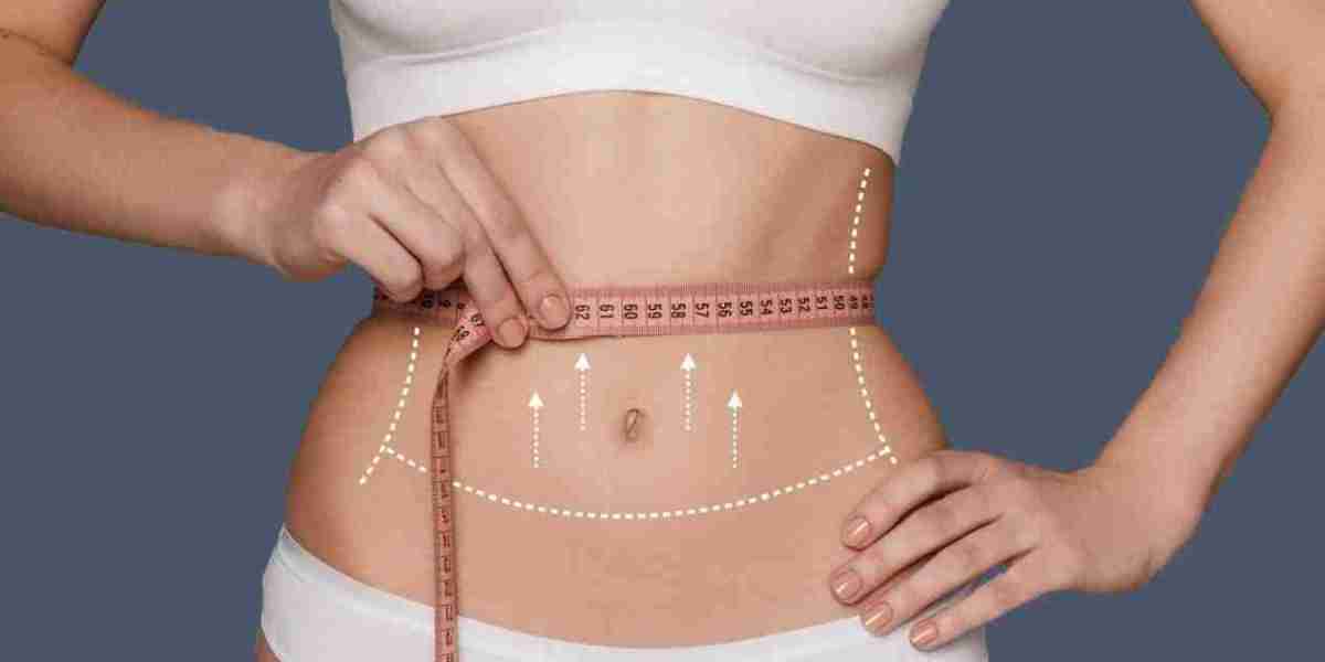 Glamorous Clinic' Guide to Lipo-Abdominoplasty in Islamabad