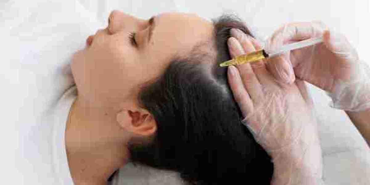 Why Mesotherapy for Hair Loss in Dubai is Gaining Popularity