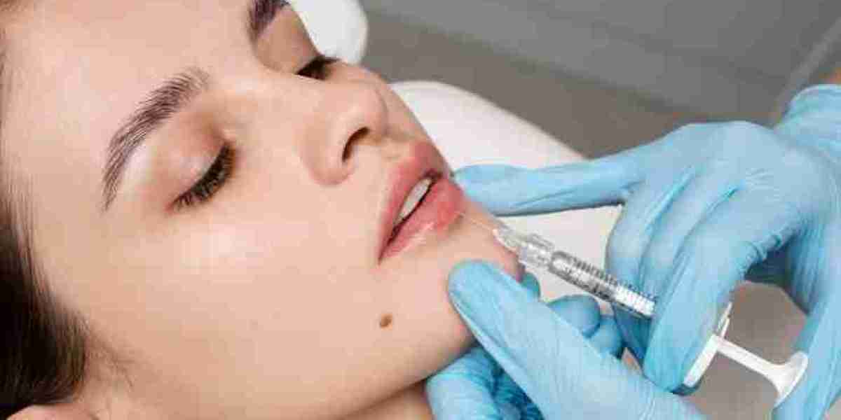 The Ultimate Guide to Fillers in Manchester: What You Should Know