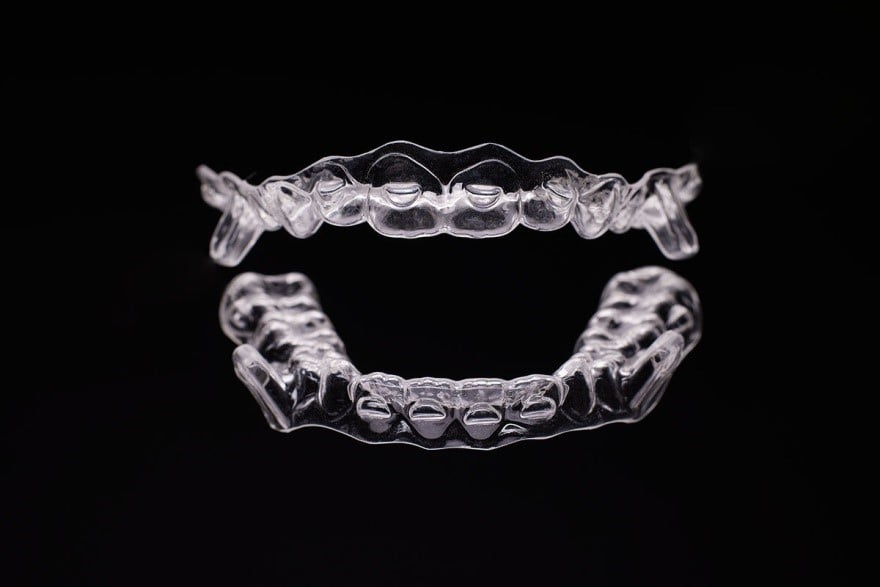 How Teeth Aligners Can Improve Your Smile Without the Hassle