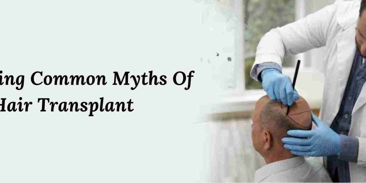 Debunking Common Myths Of Hair Transplant