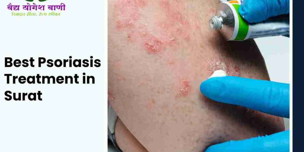 Best Psoriasis Treatment Doctor in Surat | Vaidya Yogesh Vani